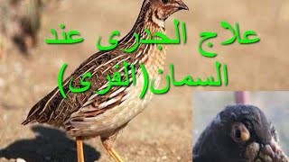 علاج الجدري عند السمان(الفري)