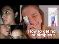 NEW DISCOVERY!!! How I keep my face pimple free | Kyline Alcantara