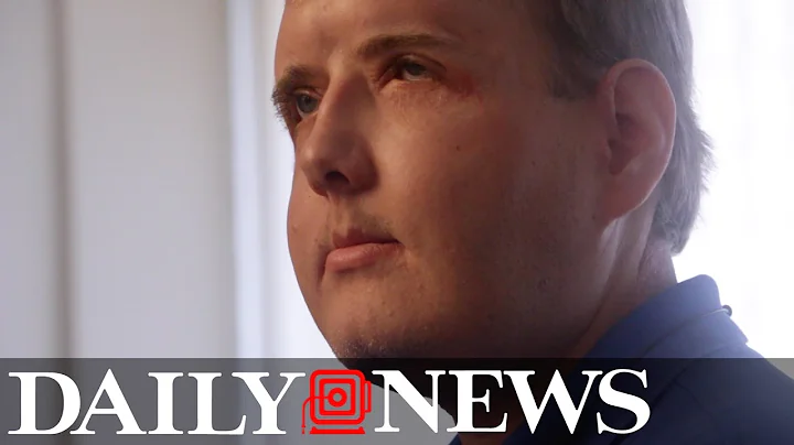 Patrick Hardison: One Year After Rare Face Transpl...