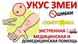 видео: УКУС ЗМЕИ: Экстренная медицинская и Домедицинская помощь; Ошибки и заблуждения; Симптомы и патогенез картинка: УКУС ЗМЕИ: Экстренная медицинская и Домедицинская помощь; Ошибки и заблуждения; Симптомы и патогенез