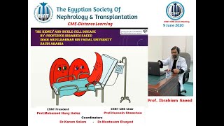 The Kidney in sickle cell disease. prof. Ibrahiem Saeed Abdulrahman, 9 June 2020