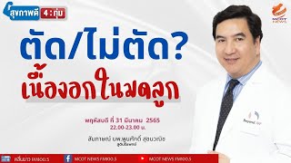 ตัดไม่ตัด? เนื้องอกในมดลูก