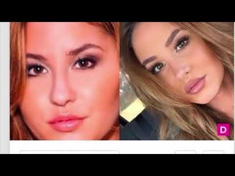 CATHERINES NOSE JOB | the ace family