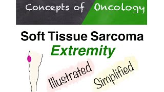 Extremity soft tissue sarcoma screenshot 5