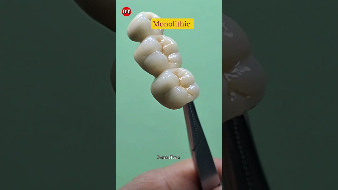 Ceramic anatomy| dental technician| laboratory| posterior| ceramic video| dental video| anterior|lab