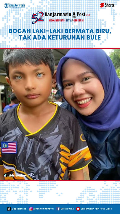 Viral Seorang Anak Laki-laki Bermata Biru, Orang Tua Lansung Cek Silsilah