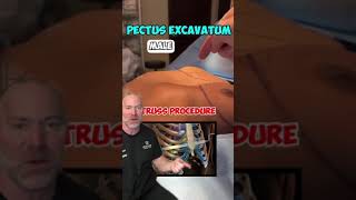 Removing Male Breast Tissue?! 😱  #shorts