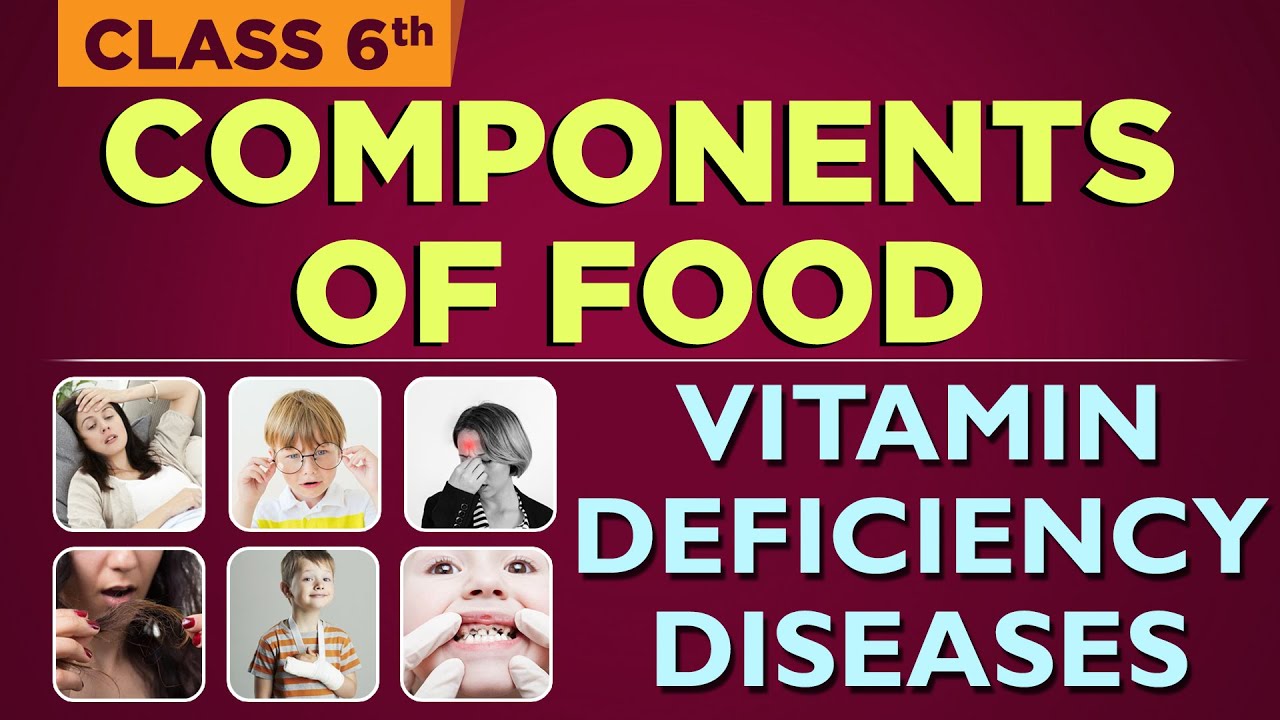 Vitamin Deficiency Quiz CBSE 6th Class Science 6th Components of