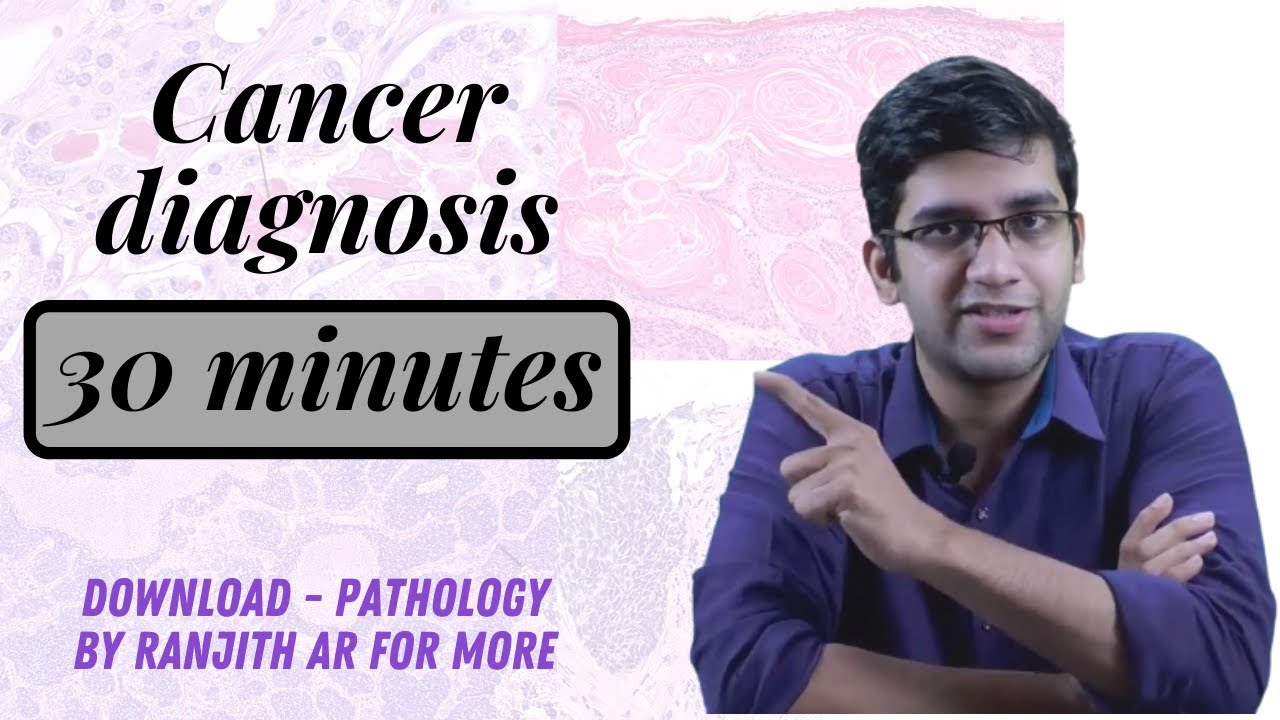 Паттерны неоплазий — обязательно к просмотру всем выпускникам медицинских вузов