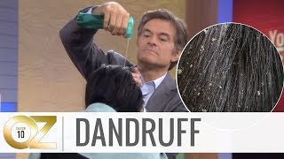 Quick and Easy Home Remedies For Dandruff screenshot 3