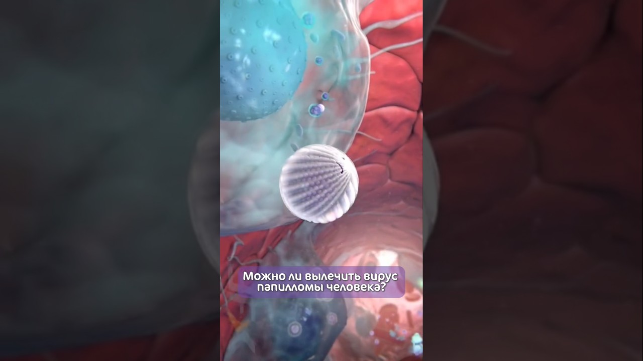Лечится ли вирус папилломы человека? Отвечает гинеколог Вандалковская Наталия Михайловна.