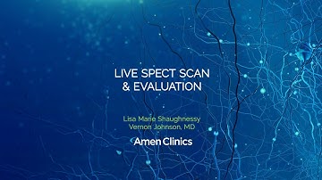 What a Brain Scan Evaluation Looks Like - Live Evaluation with Dr. Vernon Johnson