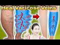 1 Minute Shaking Legs Before Sleep will Remove Swelling and Pain of Varicose Veins
