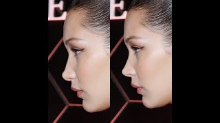 Dr. Bader NOSE Hollywood, episode 3: Bella Hadid