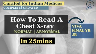 How To Report Chest X-ray | Normal & Abnormal Chest X-ray Interpretation | For Indian Medicos | Muhs