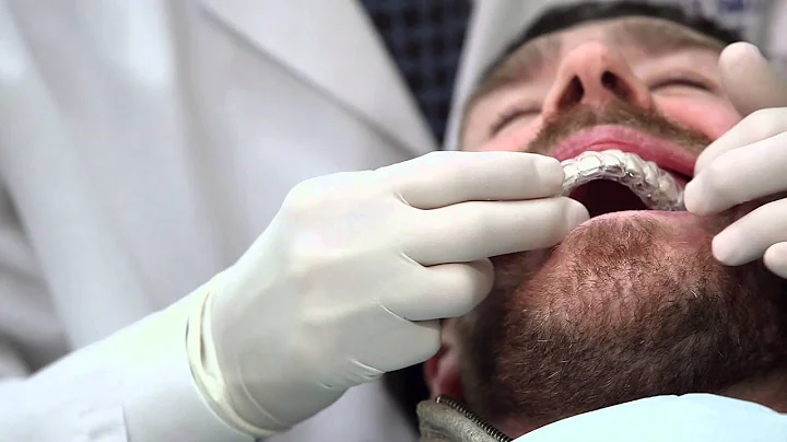 Why choose An Orthodontist Instructional Video