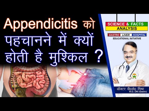 Appendicitis || Why It Is Difficult To Diagnose Appendicitis