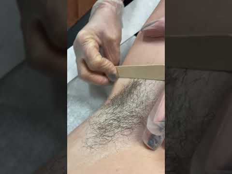 Underarm Wax Demonstration Part 1 - Hair Removal