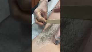 Underarm Wax Demonstration Part 1