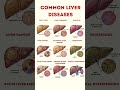 9 Liver Diseases You Should Know
