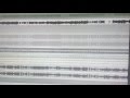 Mesmera - Album Teaser