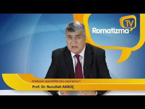 Ankilozan spondilite tanı nasıl konur?