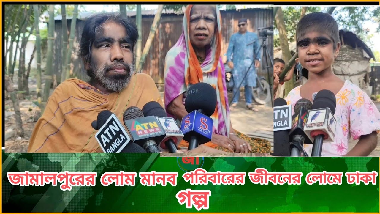 শিরিনা আক্তার: জামালপুরের লোম মানব পরিবারের জীবনের লোমে ঢাকা গল্প
