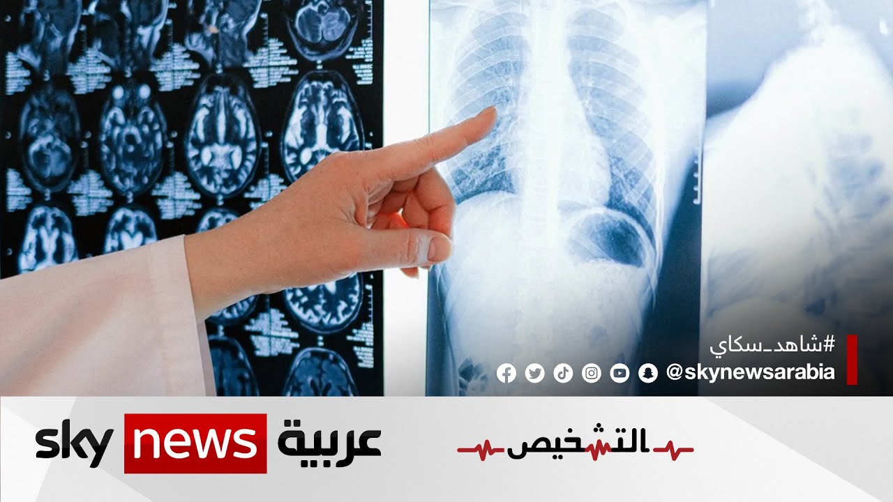 سرطان الرئة..الأعراض والعلامات الأولية للإصابة | #برنامج_التشخيص