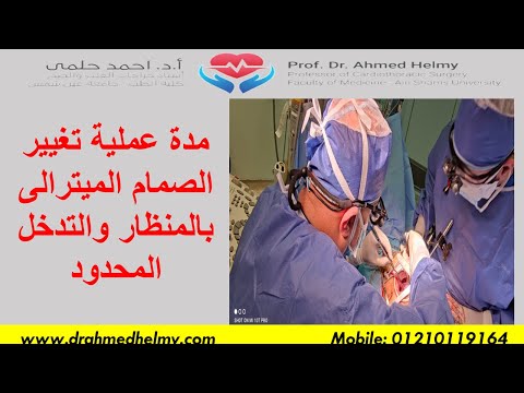مدة عملية تغيير الصمام الميترالى بالمنظار خطوات استبدال الصمام الميترالى بالمنظار