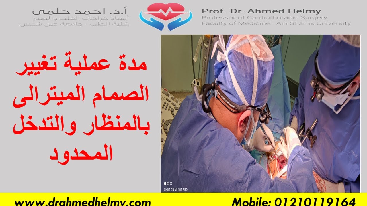 مدة عملية تغيير الصمام الميترالى بالمنظار - خطوات استبدال الصمام الميترالى بالمنظار