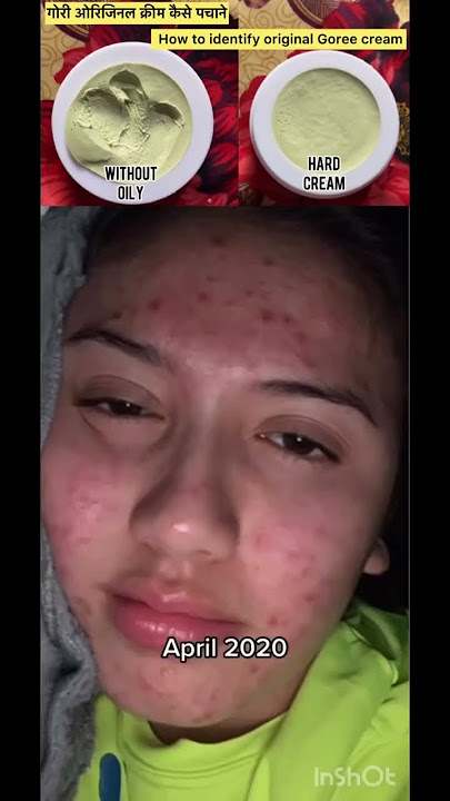 Goree cream | Goree whitening cream | pigmentation cream | dark spots remove cream |#shortvideo