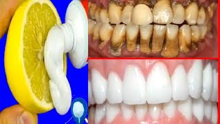 Teeth Whitening In Just 2 Minutes & How To Whiten Your Teeth At Home shorts