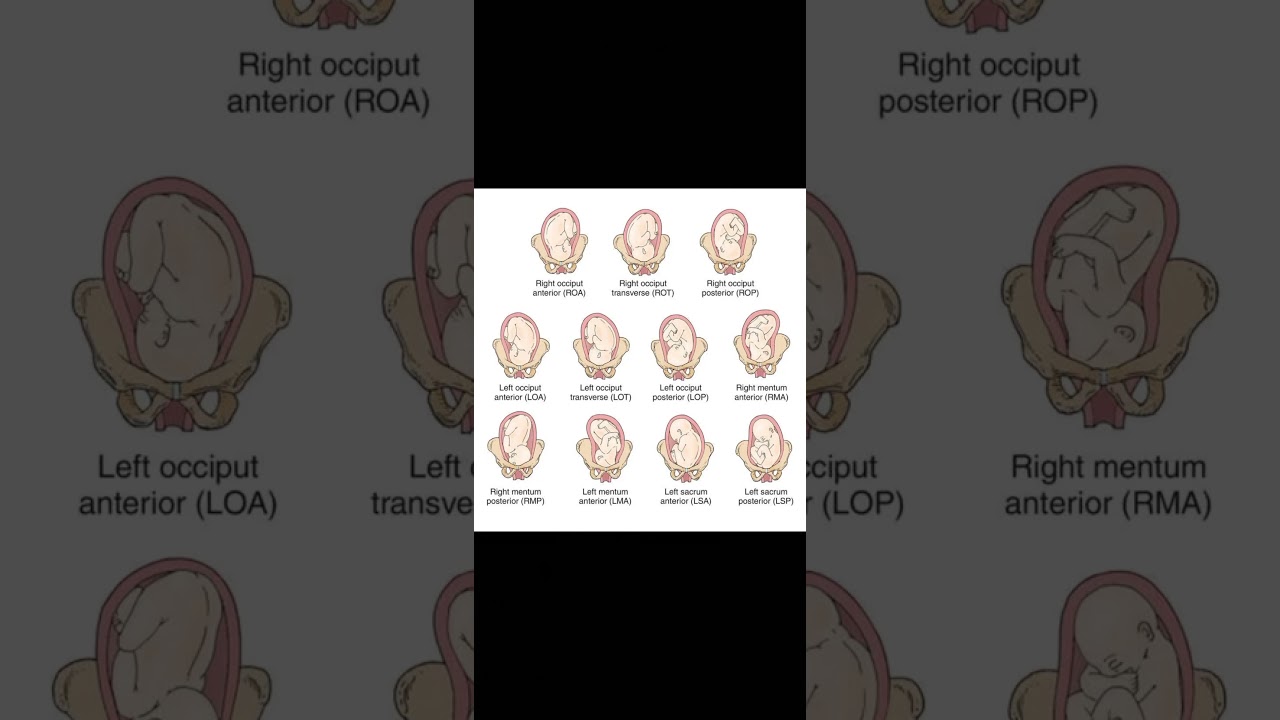 Fetal Position