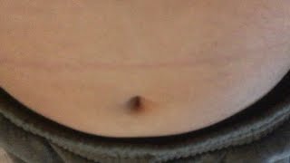 My Belly Gurgles I Digest Soy Milk, Orange Juice My Morning Breakfast Digested In My Stomach