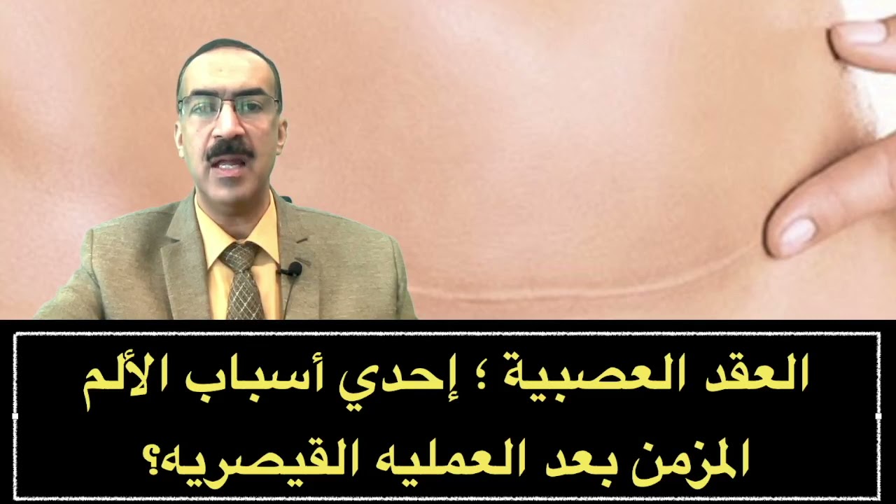العقد العصبية ؛ إحدي أسباب الألم المزمن بعد العمليه القيصريه