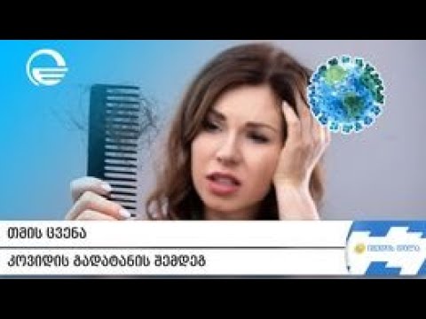 თმის ცვენა   კოვიდის გადატანის შემდეგ