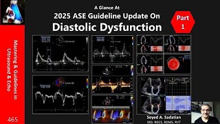 2025 ASE Guideline Update On Diastolic Dysfunction-Part 1