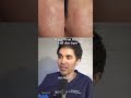 OPINIONES DEL DR. QAZI SOBRE LOS PÉPTIDOS