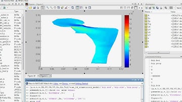 MATLAB Finite Element Program for Solving 2-D Elastic Problems in Biomechanics: Hip Sol