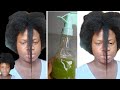 How to detox your scalp for fast hair growth/diy scalp detox two ingredients