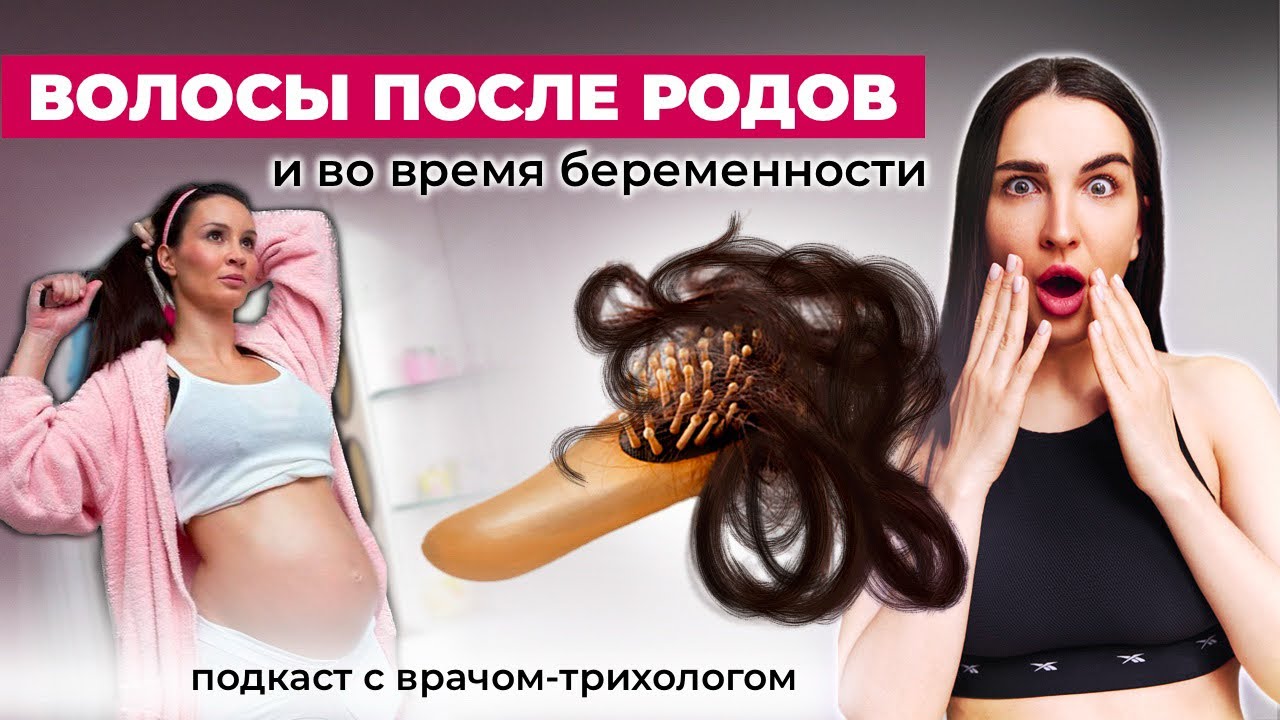 Волосы после родов выпадают | можно ли красить волосы во время беременности? | подкаст с трихологом