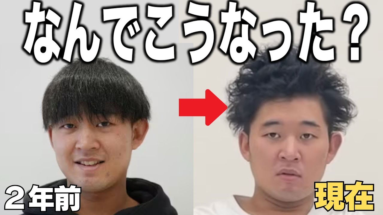 後藤の頭がデカくなり続ける理由【ハリー・スタイルズ】