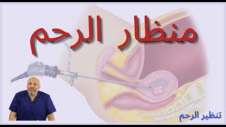 الحلقة (الثانية ) منظار الرحم