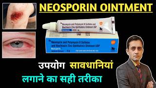 Neosporin Ointment / Neosporin Ointment Uses / Neosporin Antibiotic Ointment