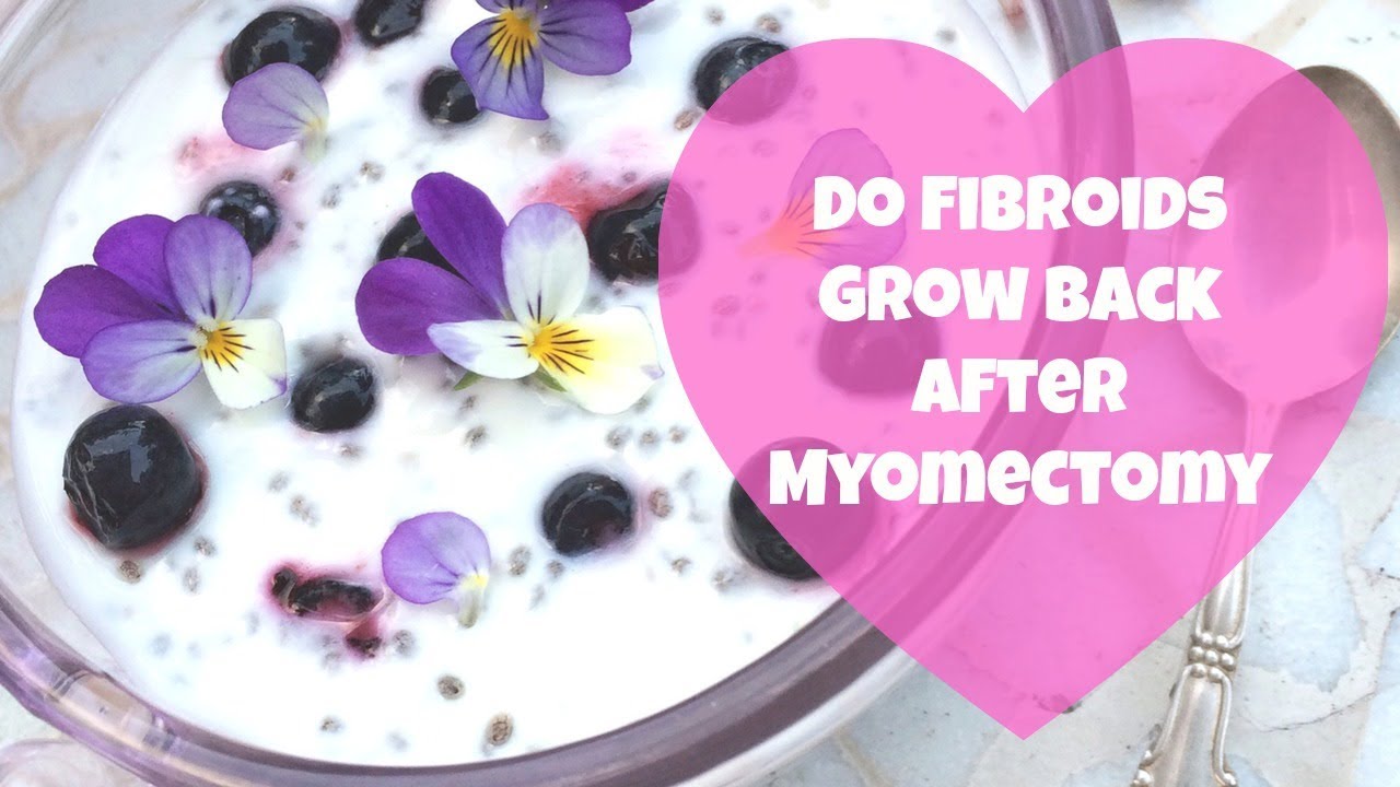 Do Fibroids Grow Back After Myomectomy By What Chelsea Eats YouTube
