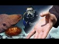 When A Giant Moray Attacks: The Extraordinary Journey of a Toe-to-Thumb Transplant&quot; | River Monsters
