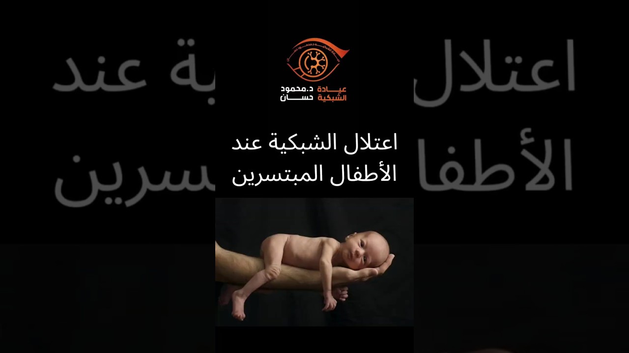 Retinopathy of prematurity