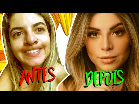 TUDO SOBRE MINHA RINOPLASTIA