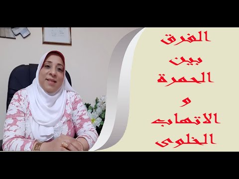 الفرق بين الحمرة و الالتهاب الخلوى د هيام