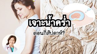 [QA] เจาะน้ำคร่ำตอนอายุครรภ์กี่สัปดาห์ | DrNoon Channel